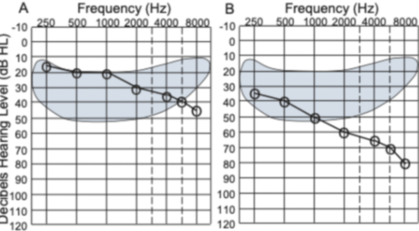 <p>-distribution of speech sounds at a normal conversational level ranges from 20 to 50 dB HL</p><p>-consonants are generally lower in intensity and higher in frequency</p><p>-vowels are generally higher in intensity and lower in frequency</p><p>-anything below the line are sounds they can hear and above are ones they can't</p>
