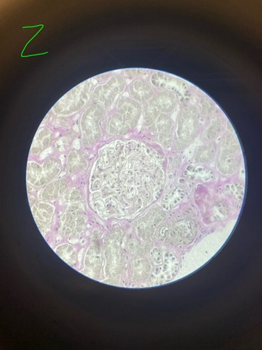 <p>What stain is this?</p>