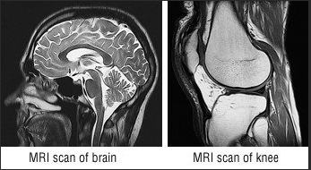<p>MRI (magnetic resonance imaging)</p>