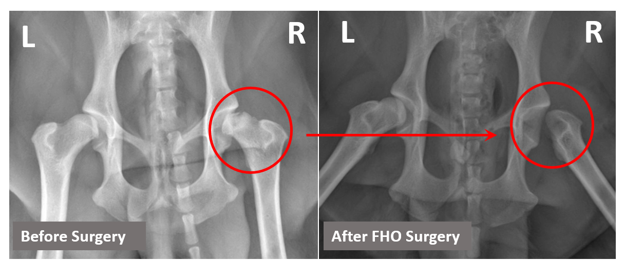 Mild (activity restriction, NSAIDs), severe (femoral head and neck ostectomy/total hip replacement)
