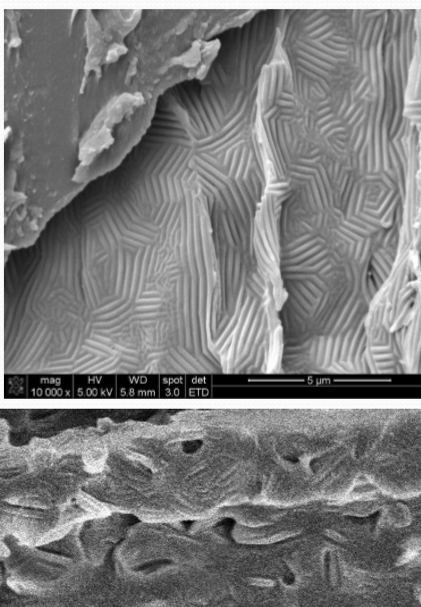 <p>Nuclear microridges </p>