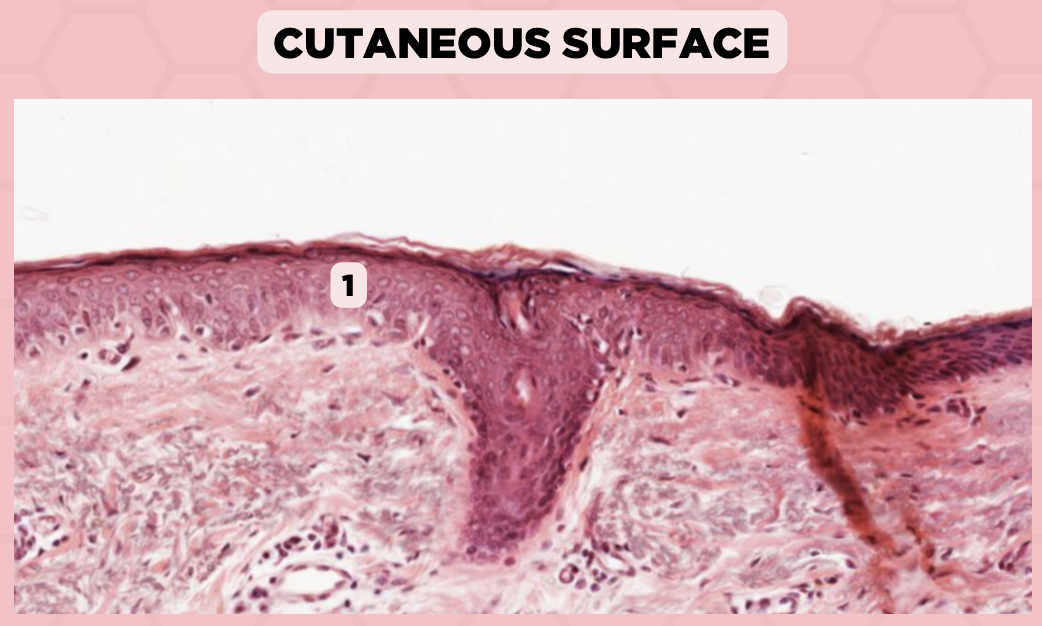 <p>Identify the structure labelled in the given image?</p><p>a. Epidermis</p><p>b. Dermis</p><p>c. Hypodermis</p><p>d. Mucosa/Mucous Membrane</p>