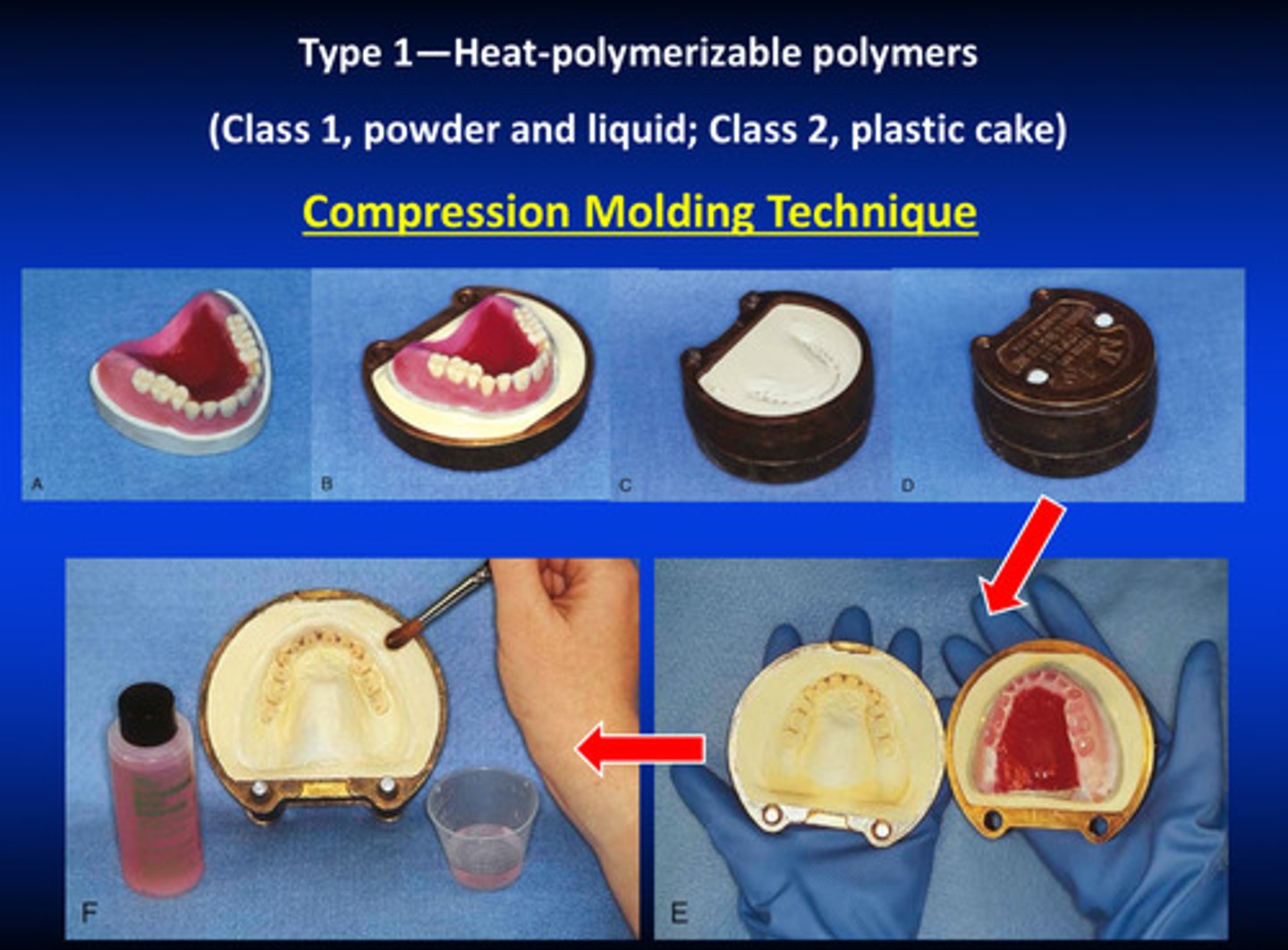 <p>1) wax up denture base with baseplate wax</p><p>2) create teeth and put in correct position</p><p>3) embed the denture into plaster</p><p>4) we soften the wax; one side of the plaster holds the denture teeth and is detached from the base</p><p>5) clean up and add separator</p>