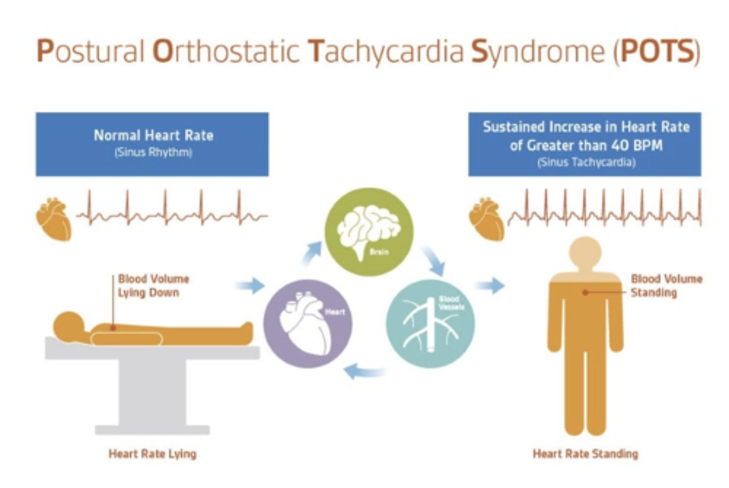 <p>An autonomic nervous system condition that causes heart palpitations, lightheadedness, increased heart rate, low blood pressure, low blood volume, inability to concentrate, "brain fog," trouble sleeping, gastrointestinal symptoms, and dark red-blue discoloration of the legs.</p>