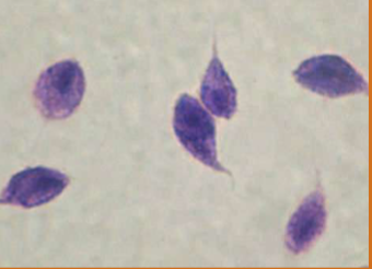 <p>does <span style="color: rgb(254, 250, 250);"><span>Tritrichomonas spp have a cyst stage </span></span></p>