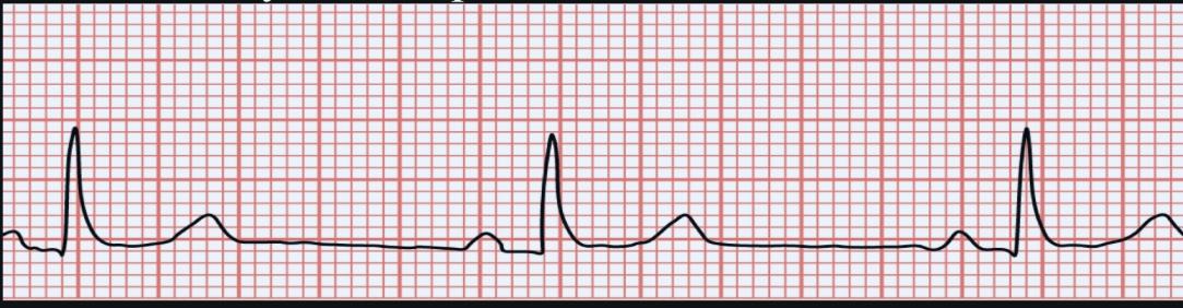 <p>ECG interpretation</p>