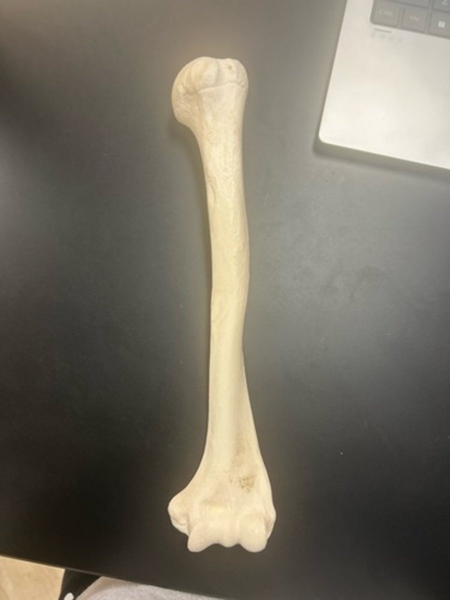 <p>name the bone</p>