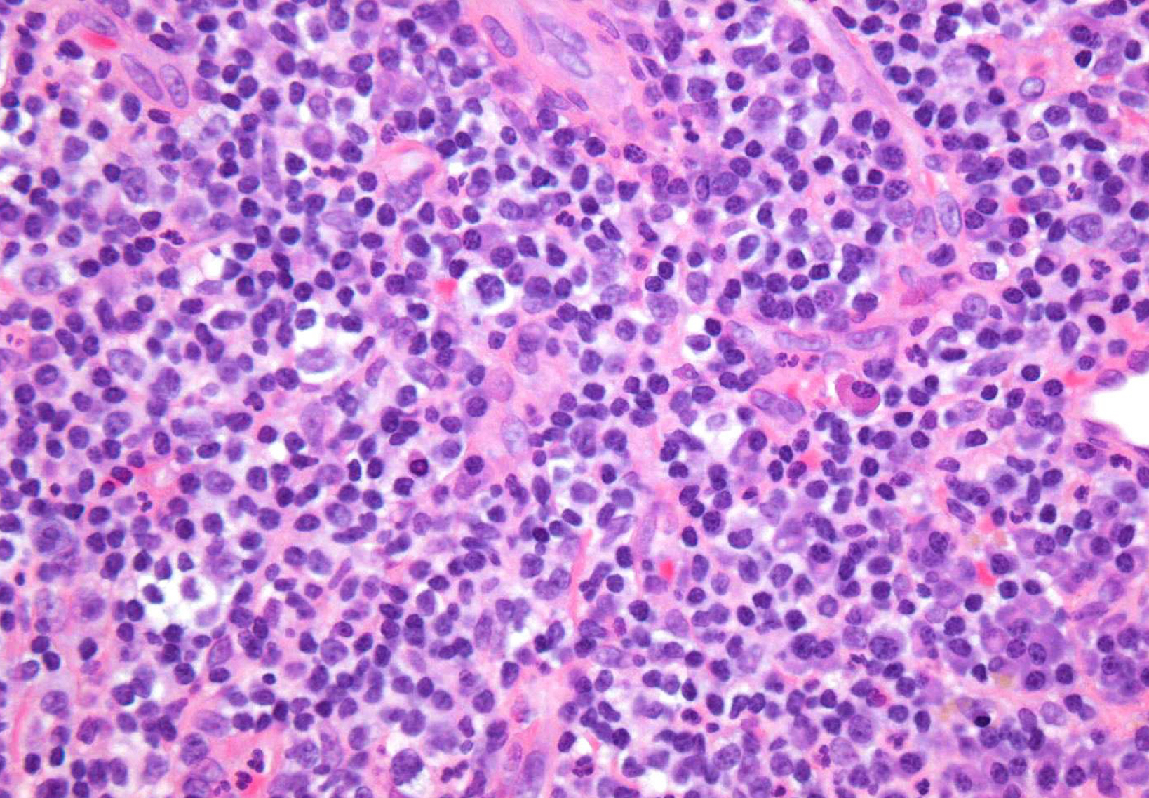 <p>which potential result of periapical inflammation?</p>