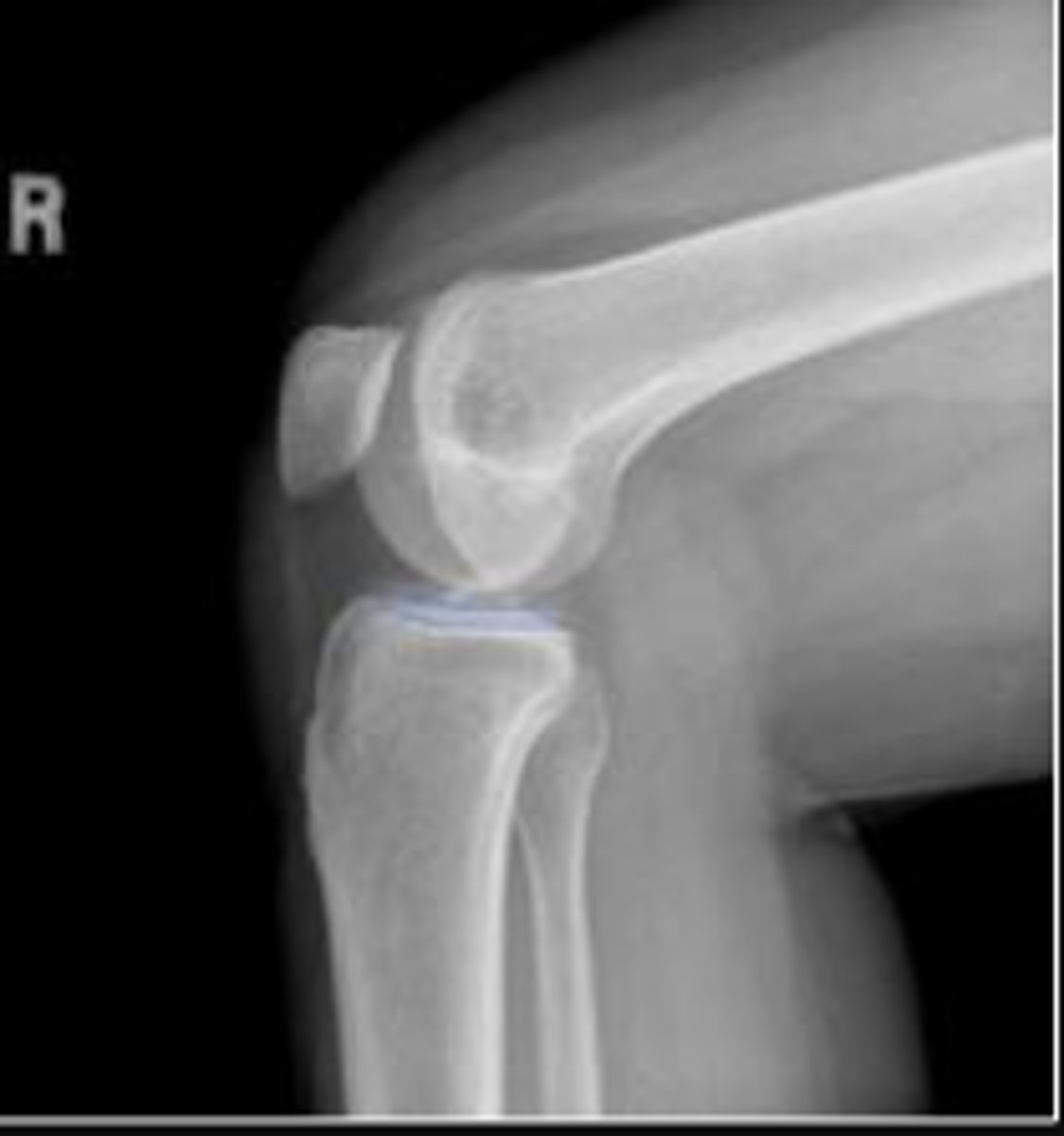 <p>What is outlined?</p>