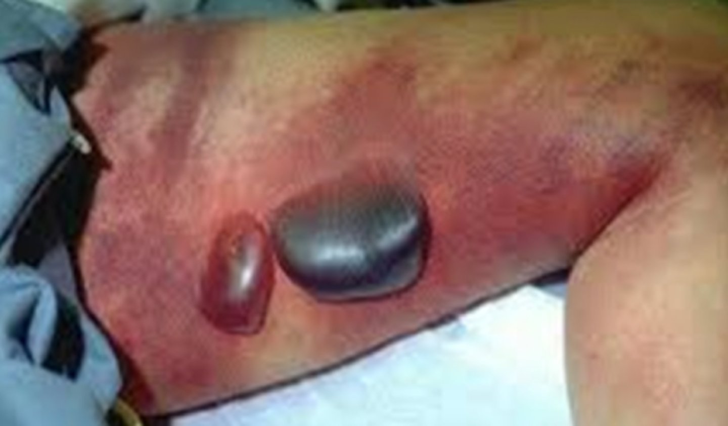 <p>What is the diagnosis?</p>