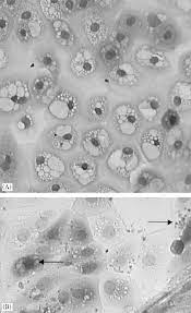 <p>is characterized by closely packed layers, varying shapes (cuboidal, columnar, squamous), and functions in protection, absorption, and secretion. </p>
