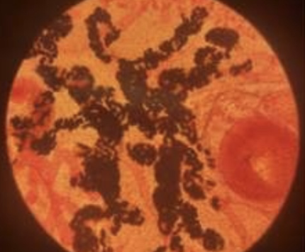 <p>Fasciola hepatica (liver fluke)</p>