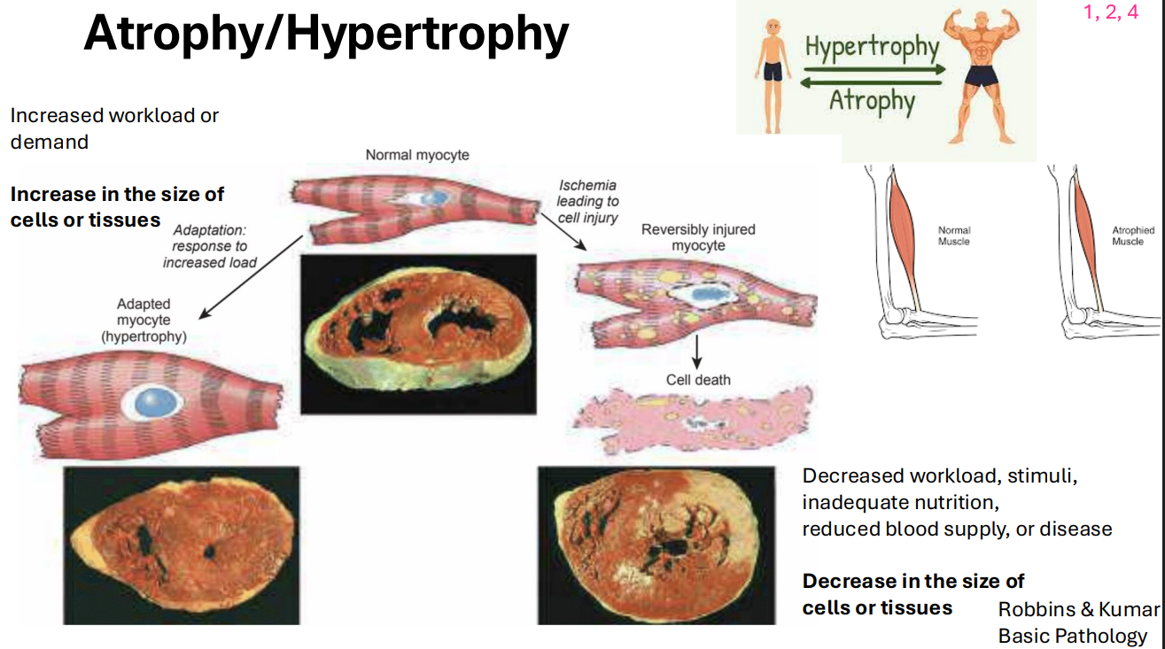 <p>- one of the ways that cells adapt to injury</p><p>- increased workload or demand results in increase in the size of cells or tissues</p>