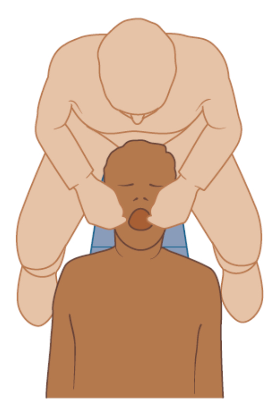 <p><strong>What clock position is this?</strong></p>
