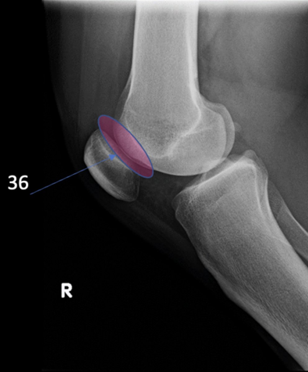 <p>ID 36 (joint)</p>
