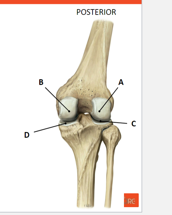 <p>Name the structures in the art. genus / knee joint (art. femorotibialis):</p>