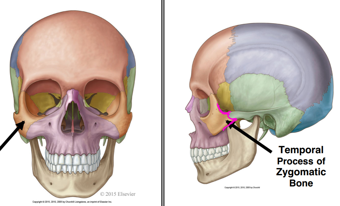 <p>what bone are the arrows pointing at</p>