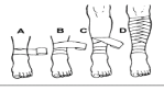 <p>use this  to cover small to large conical areas, for example, from ankle to knee </p>