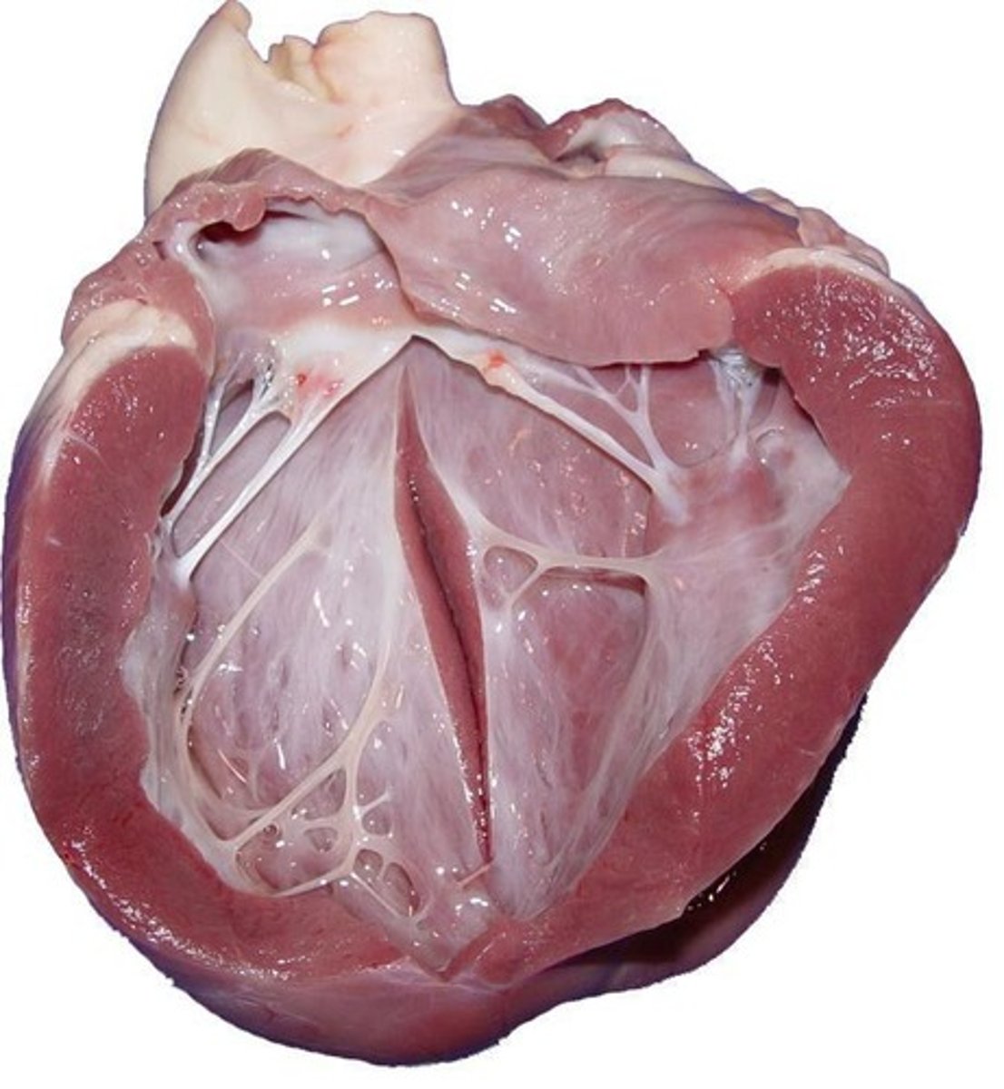 <p>Small strands of connective tissue that bind distal parts of valve leaflets.</p>
