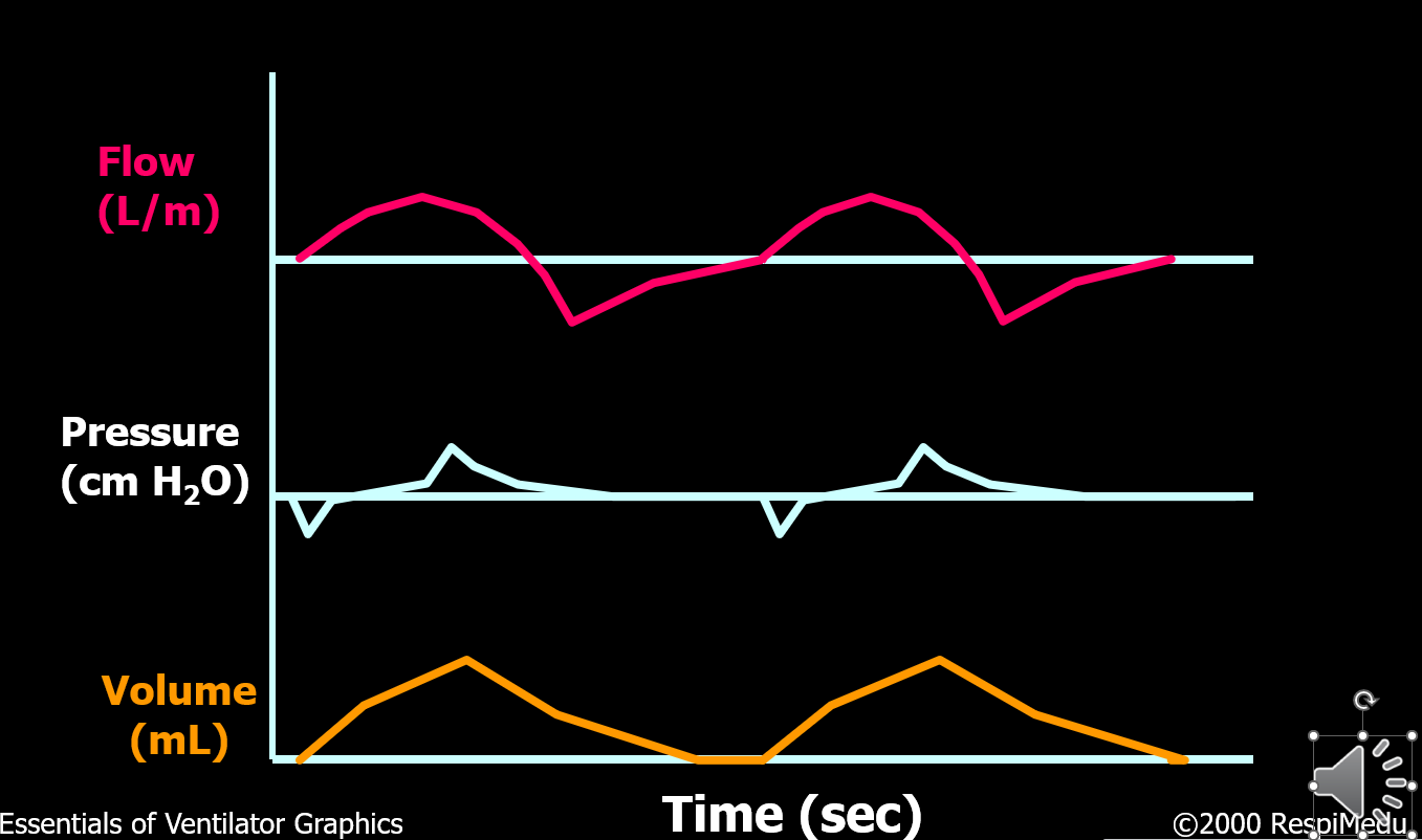 <p>What type of breath is this?</p>
