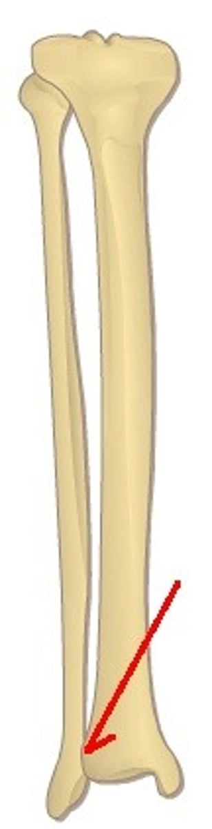 <p>articulation between the distal fibula and the fibular notch of the tibia</p>