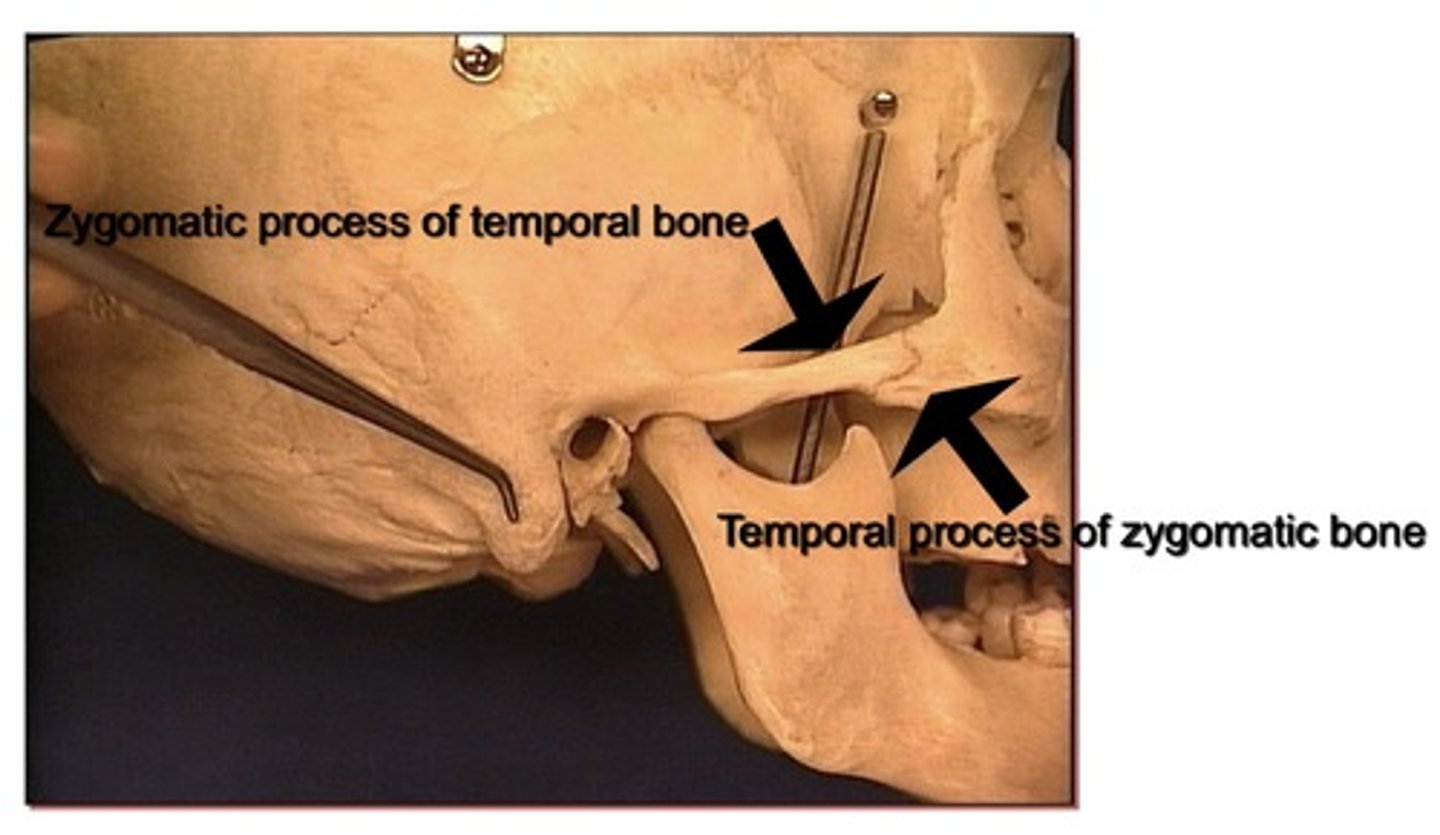 <p>1. Immediately lateral to the maxillary bone</p><p>2.Inferior lateral to the frontal bone in the orbit.</p>