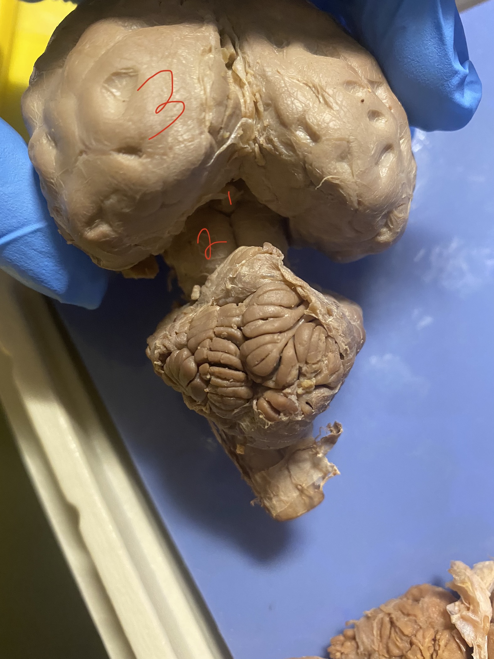 pineal gland 