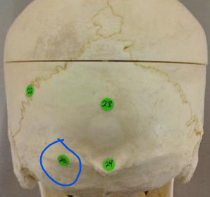 <p>#25 - <span><span>4 curved lines on the external surface of the </span></span>occipital bone that attach to different muscles and ligaments (posterior skull)</p>