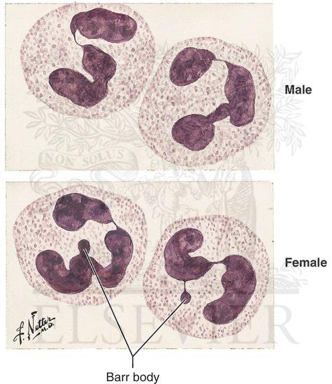 <p>Sex chromatin or Barr body</p><p>• Dark staining heterochromatic mass</p><p>• Lying against the inner surface of the nuclear membrane of interphase female</p><p>cells only e.g. neutrophils from a normal female</p>
