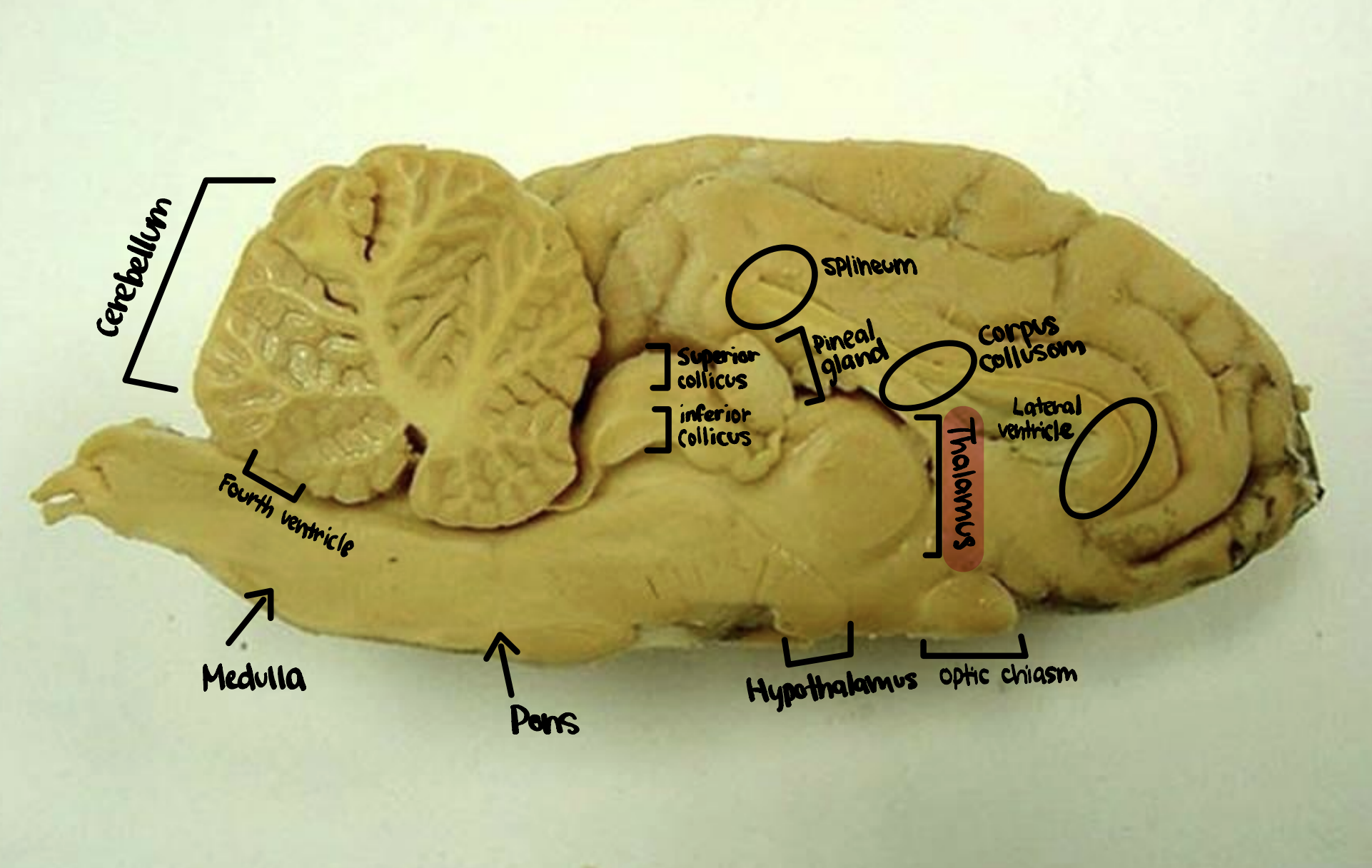 <p>Thalamus</p>