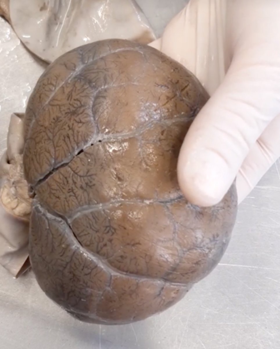 <p>What is the name of the veins?</p>