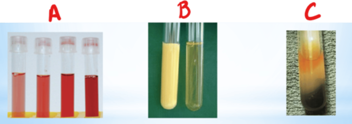 <p>1. hemolysis: red plasma/serum</p><p>2. icterus: dark orange plasma/serum</p><p>3. lipemia: very turbid plasma/serum</p>