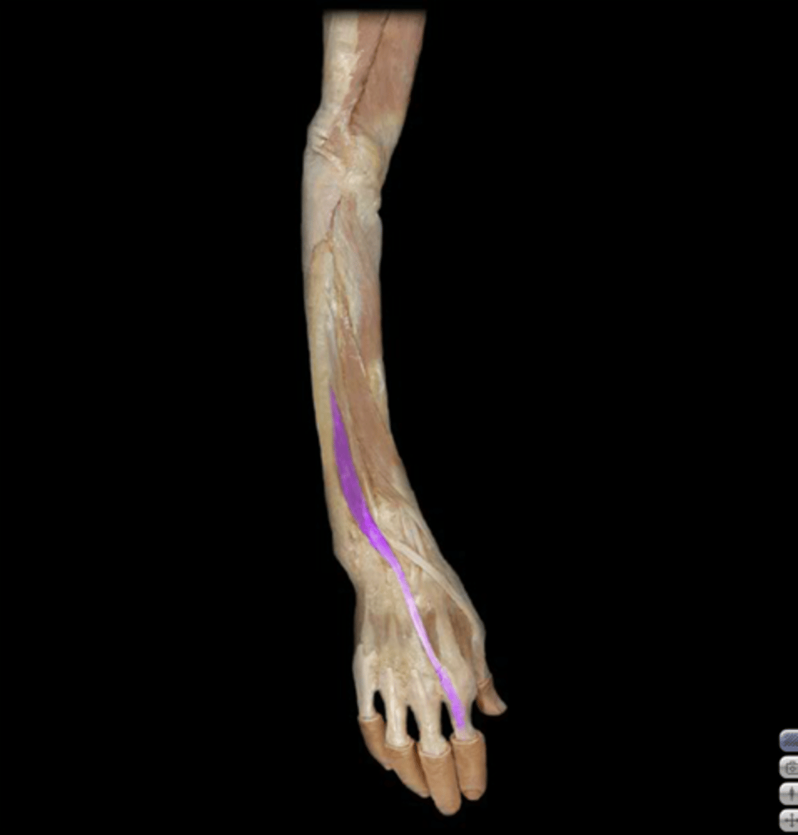 <p>Action: extension of wrist and digit 2</p><p>Origin: Distal third of ulna and interosseous membrane</p><p>Insertion: Digit 2 extensor expansion</p><p>Innervation: Posterior interosseous nerve (PIN): continuation of deep branch of the radial nerve</p><p>Dorsal extensor compartment: 4th compartment</p>