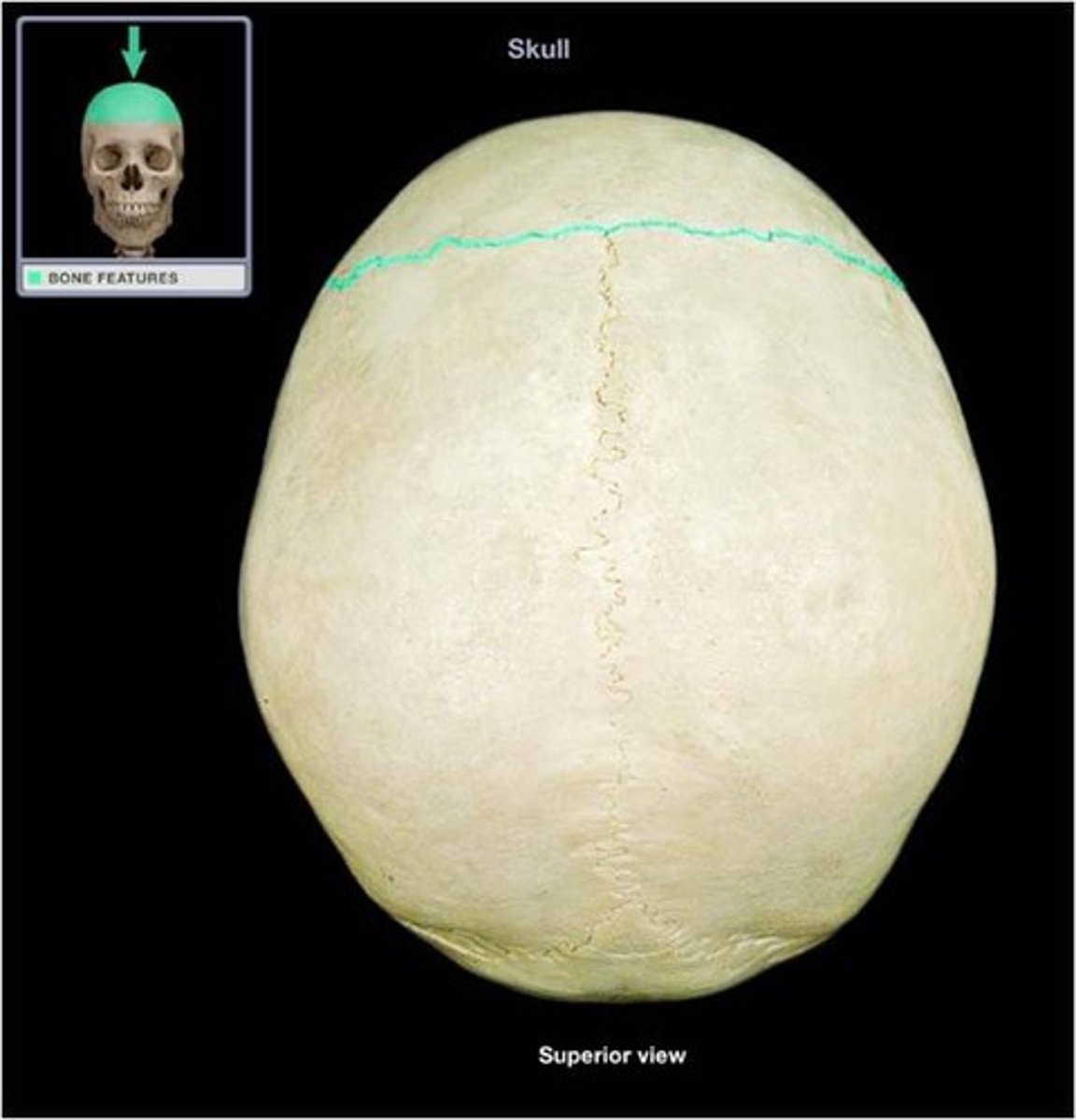 <p>This suture joins the parietal bones to the frontal bone.</p>