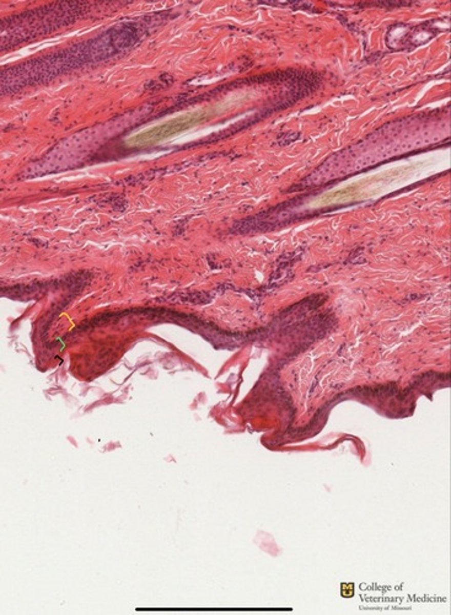 <p>What tissue type is this from?</p><p>What three layers are present shown via the colored brackets?</p>
