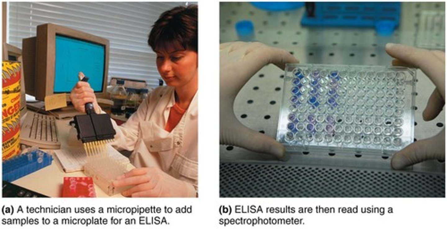 <p>Test using known antibodies to identify unknown bacteria.</p>