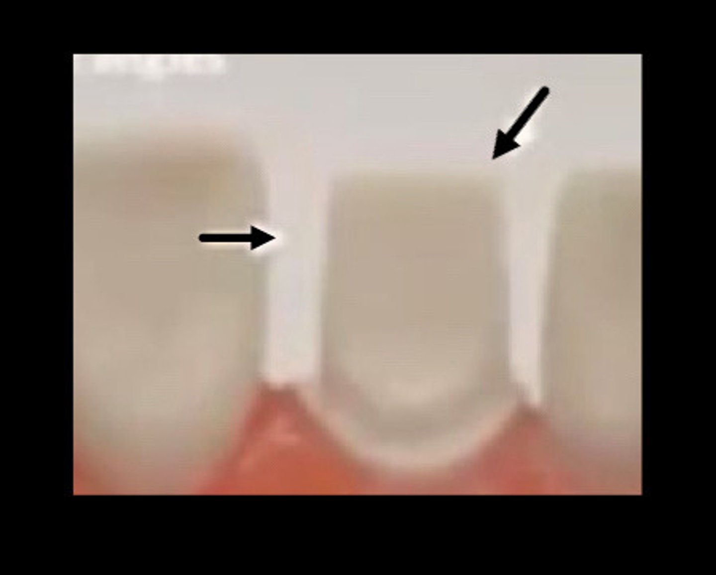 <p>A common error are</p>