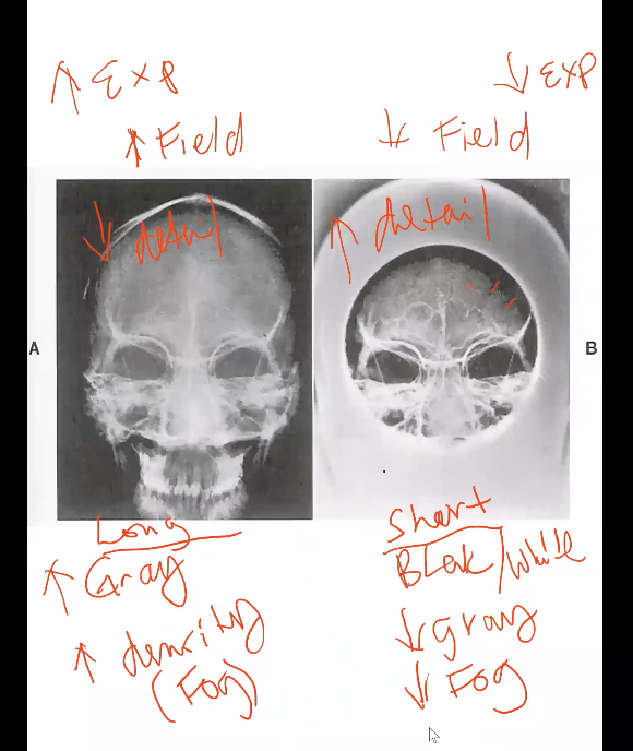<p><strong>How does a <u>bigger Field Size</u> affect contrast and exposure to the patient?</strong></p>