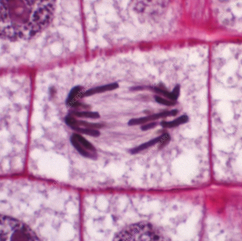 <p>what stage of the cell cycle is being showed here ?</p>
