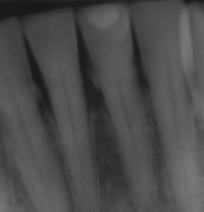 <p>local/initiating factor</p>