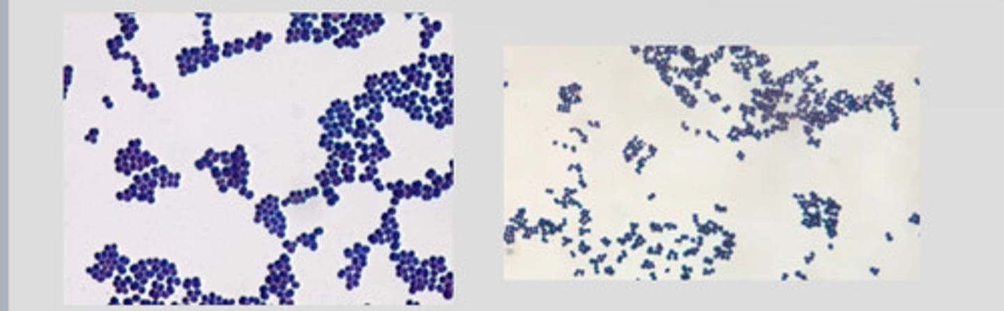 <p>a form of staphylococci that commonly infects wounds and causes serious problems such as toxic shock syndrome or produces food poisoning</p>