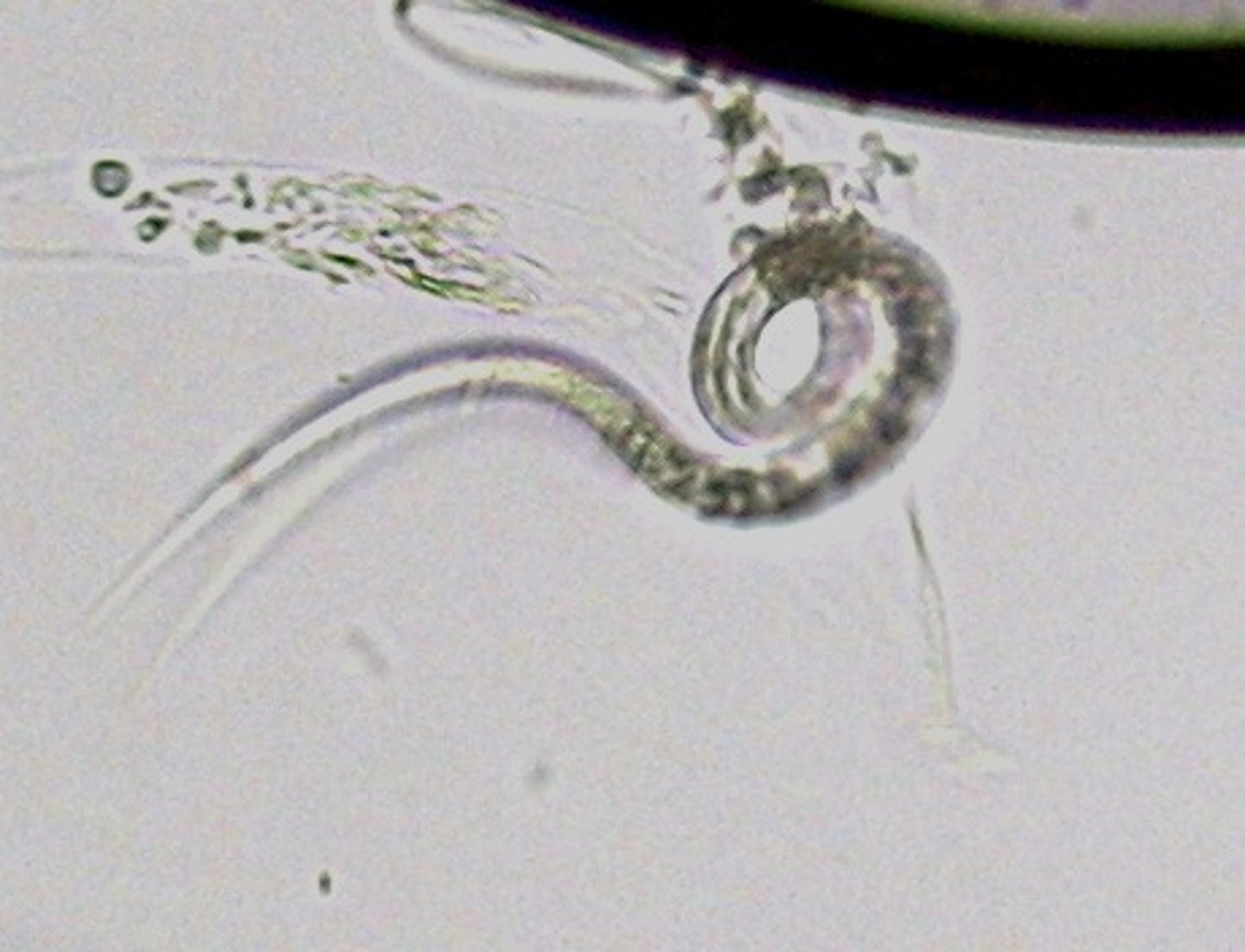 <p>Phylum Nematoda</p>
