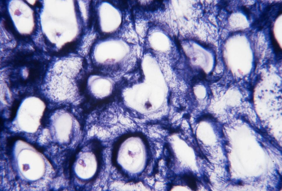 <p>what is this CT</p>