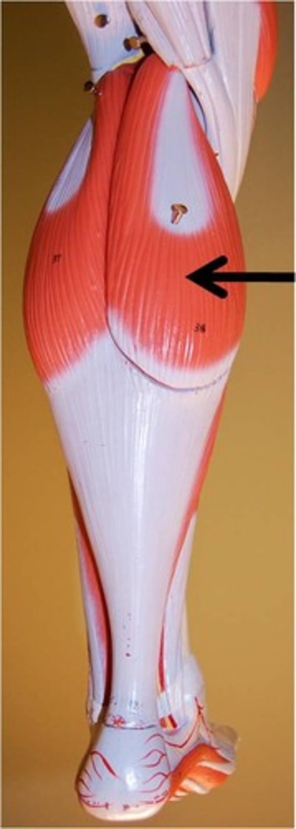 <p>Prime mover for plantar flexion, "toe dancer's muscle"</p>