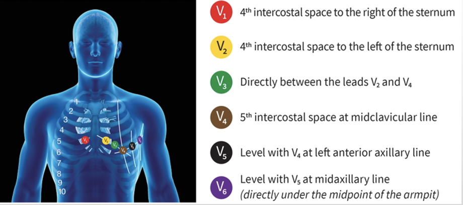 <p>What are the precordial leads?</p>