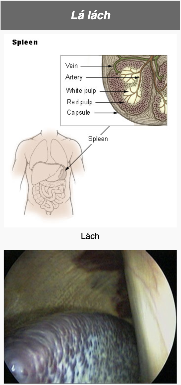 <p>Spleen (splen-)</p>