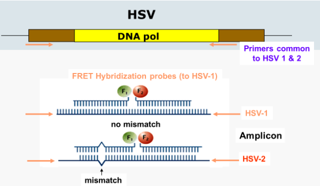 <ul><li><p>can make FRET probes to HSV-1 and HSV-2</p></li><li><p>if the probes attach to the amplicon DNA without a mismatch, then HSV-1 is suspected</p></li><li><p>HSV-2 is suspected when there is a mismach in the FRET probes</p></li><li><p>can be confirmed with a melt curve (measuring the change in fluorescence)</p><ul><li><p>due to the probe having a mismatch with HSV-2, the probe will dissociate from the product at lower temperatures</p></li></ul></li></ul><p></p>