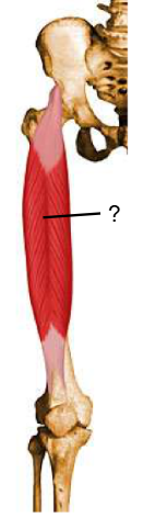 <p>Nom et caractéristiques de cette structure ?</p>