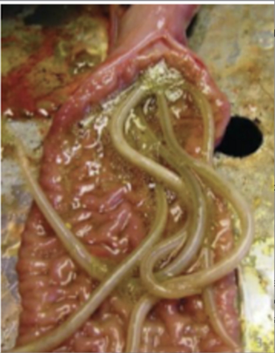 <p>What is the parasite depicted in this picture?</p>