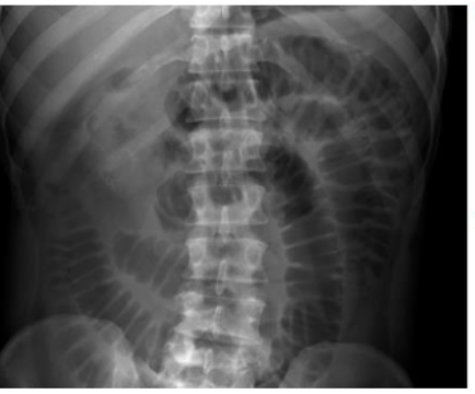 <p>What is this and what type of scan </p>